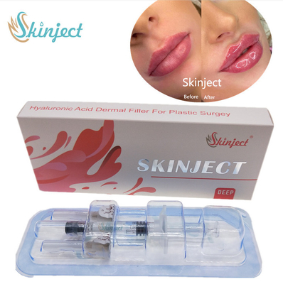 Injectable Skinject Deep HA Dermal 2ml Lips Fillers Cheek Chin Nasolabial Fold
