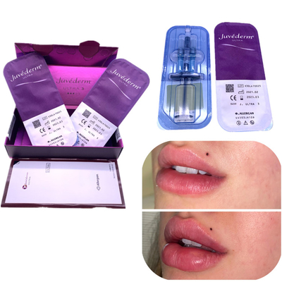 Injection Ha Filler Juvederm 2x1ml Lip Enhancement Remove Wrinkles