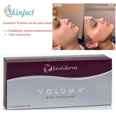 Face Care 2x1ml Juvederm Lip Fillers Hyaluronic Acid Dermal Injectable
