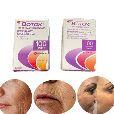 English Edition Type A Botulinum Toxin 100 Iu Allergan  For Wrinkles
