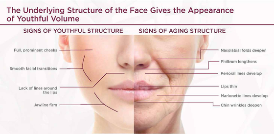 Aesthetic PLLA Replace Lost Collagen For Face Lifting