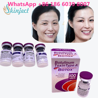 Botulinum Toxin  Wrinkle Removal 100u Allergan 100 Units For Face Lift Injection