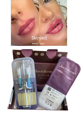 Injectable Deep Hyaluronic Acid Dermal 2ml Lip Filler Cheek Chin Nasolabial Fold