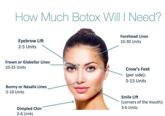 100 Iu Type A Korean Botulinum Toxin OEM Allowed