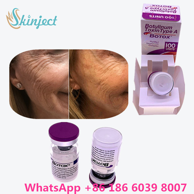 Botulinum Toxin Allergan  Type A 100units 1 Vial / Box Packing