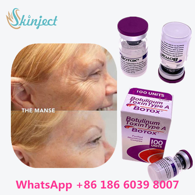 Botulinum Toxin Allergan  Type A 100units 1 Vial / Box Packing