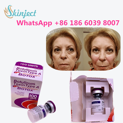 allergan botulinum toxin Anti Aging Products Type A Toxin Anti Wrinkle
