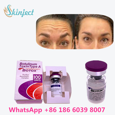 100% Original Botulinum Toxin  100u For Remove Wrinkles