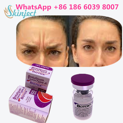 100% Original Botulinum Toxin  100u For Remove Wrinkles