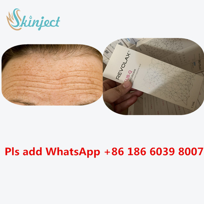 Injectable Dermal Filler Revolax 24 Mg/Ml HA Hyaluronic Acid Injection