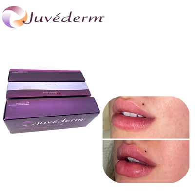 Injectable Dermal Filler Ultra3 Ultra4 Voluma For Cheekbone Lip