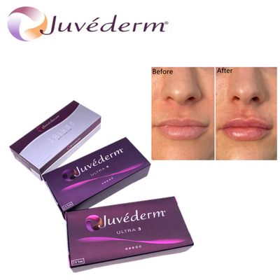 Hyluronic Acid Dermal Filler Premium Juvederm HA Facial Filler Ultra3 Ultra4 Voluma For Face Rejuvenation