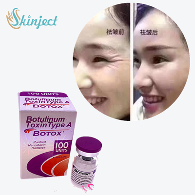 100 Units Type A Botulinum Toxin 2 - 8°C Storage Temperature
