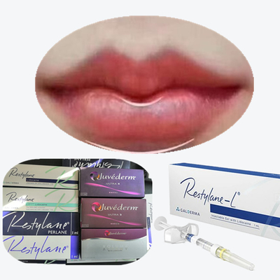 Juvederm Cross Linked Injectable Dermal Filler For Lips