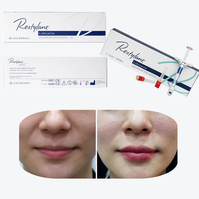 Cross Linked Hyaluronic Acid Dermal Filler For Breast Lips Augmentation