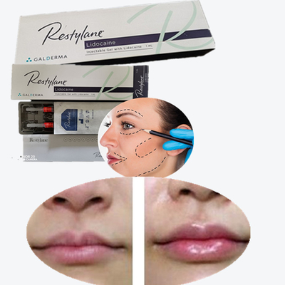 2*1ml/Box Medical Sodium Hyaluronate Gel Dermal Filler For Lips
