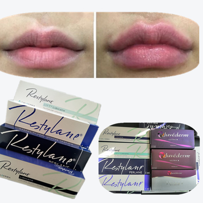 2*1ml/Box Hyaluronic Acid Dermal Filler For Lips Augmentation
