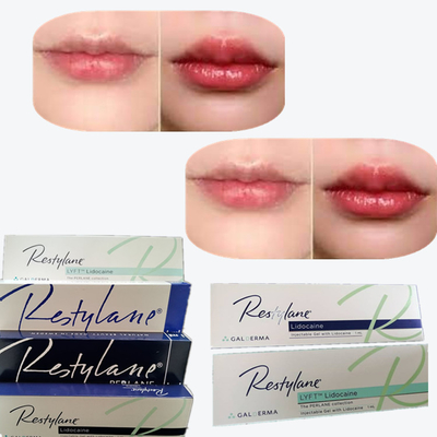 2*1ml/Box Hyaluronic Acid Dermal Filler For Lips Augmentation