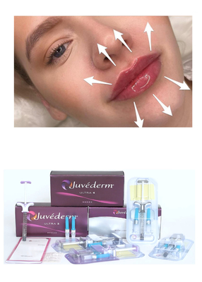 Juvederm' Hyaluronic Acid Dermal Filler Ultra3 Ultra4 Voluma Injection For Lip Filling