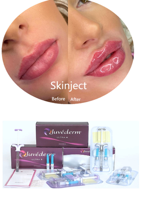 Juvederm Hyaluronic Acid Facial Dermal Filler Injectable 2*1ml Packing