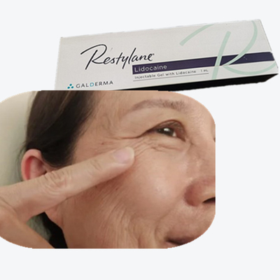 Hyaluronidase Solution Cross Linked Dermal Filler HA Injection For Nasal Lines