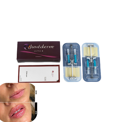 Juvederm Dermal Filler For Lips Injection Hyaluronic Acid Fillers