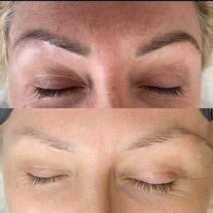 Eyebrow Removal Hair Removal Laser Beauty Machine 810nm Laser Tattoo Removal Machine