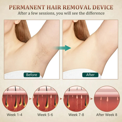 Eyebrow Removal Hair Removal Laser Beauty Machine 810nm Laser Tattoo Removal Machine