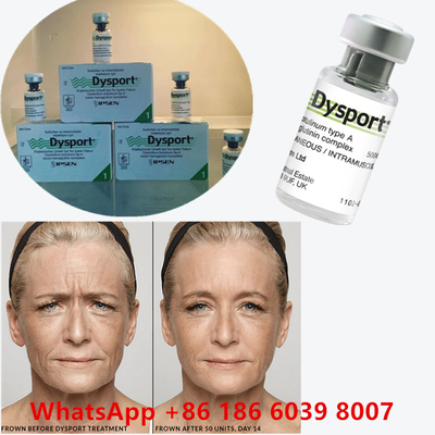 Botulinum Toxin 100 Units BTX Injection Type A Cosmetic Use