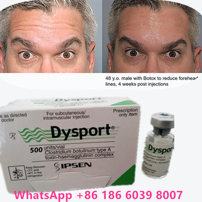 Botulinum Toxin 100 Units BTX Injection Type A Cosmetic Use