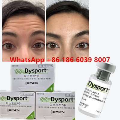 Botulinum Toxin Dysport 100u Clostridium Botulinum Type A For Facial Anti-aging Wrinkle