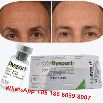 Botulinum Toxin Dysport Clostridium Botulinum Type A For Crow's Feet