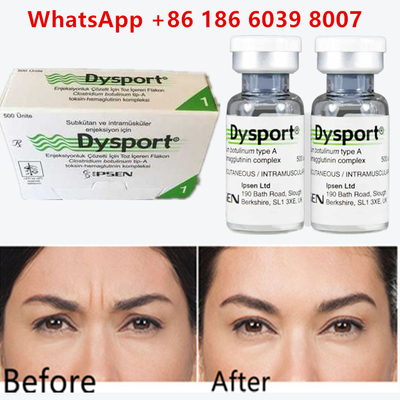 Botulinum Toxin Dysport 100u Clostridium Botulinum Type A For Forehead Wrinkles