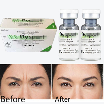 Botulinum Toxin Dysport Anti-Wrinkle Powder Freeze-Dried Powder For Glabellar Lines