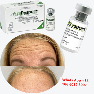 Botulinum Toxin Dysport Anti-wrinkle Freeze-Dried Powder For Smile Lift