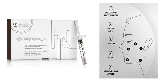 Natural-looking Lift 5-point lifting needle Profhilo Injectable Dermal Filler