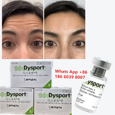Botulinum Toxin Dysport Anti-wrinkle Freeze-Dried Powder For Slimming the face