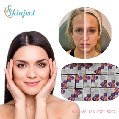 Allergan  Nobota 100u 200u for Effective Treatment of Frown Lines Botulinum Toxin Injections