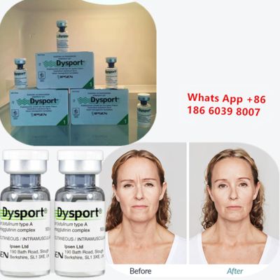  Dysport Botulinum Toxin Type A BTX Anti-Wrinkle Injection for Deltoid Muscle