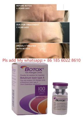 100IU Allergan Units Powder Solution Injections Botulax Botulinum Toxin Remove Wrinkles