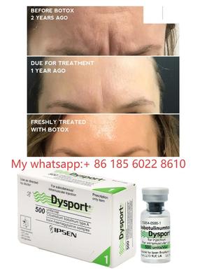 Dysport 500IU Injections Botulinum Toxin Allergan Botulax-Smooth Fine Lines and Wrinkles