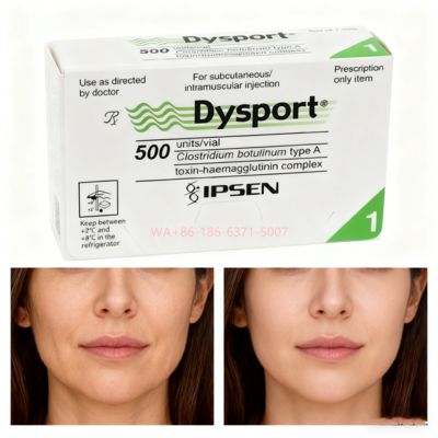 Botulinum Toxin 500U Dysport Reduce Facial Wrinkles and Restore the Skin's Smoothness