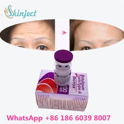 Botulinum Toxin Type A Allergan  Offering Designed for Medical and Cosmetic