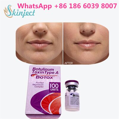 Botulinum Toxin Type A Allergan  Offering Designed for Medical and Cosmetic