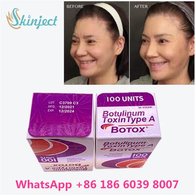 Allergan Botox Botulinum Toxin Type A 100 Units for Wrinkle Removal with 4~6 Months Duration