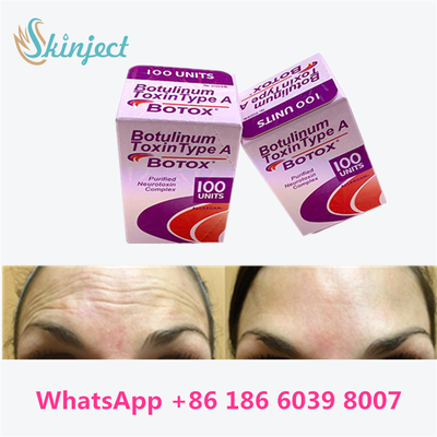 Botulinum Toxin Medical-Grade Botulinum Toxin For Aging Treatment at Home