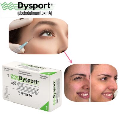500u Dysport Facial Wrinkle Disappearance Freeze-dried Powder Processing Custom OEM Dysport