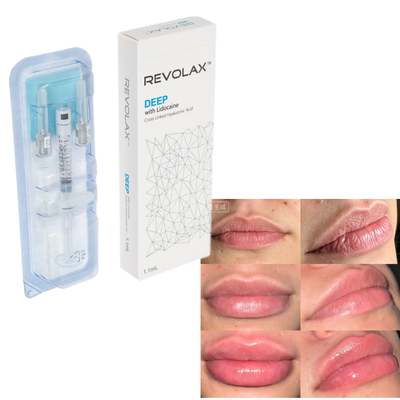 Revolax Hyaluronic Acid Dermal Filler Natural Plump Lip Augmentation Facial Volume Restoration