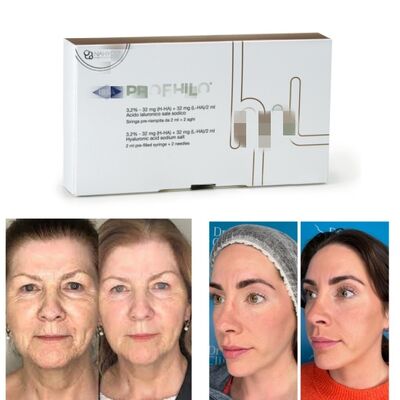Profhilo Treatment Hyaluronic Acid Skin Booster & Bio-Remodelling