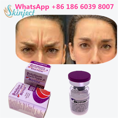 Botulinum Toxin BOTOX Cosmetic 100 Units Allergan OnabotulinumtoxinA for Facial Wrinkles